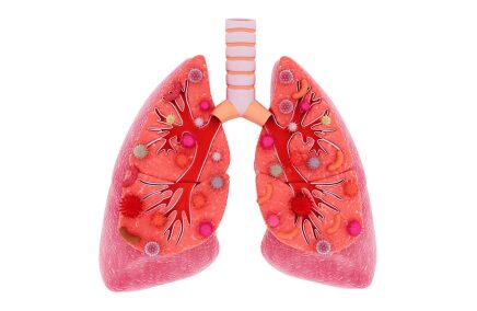 Dr. Om Prakash, MBBS, MD, FCPNC: Best Internal Medicine Physician & Non-Invasive Cardiologist in Noida | Book Appointment at 7982454504