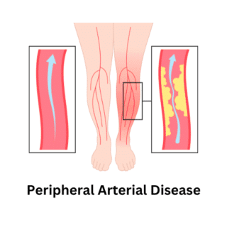 Dr. Om Prakash MBBS, MD Internal Medicine, Best Internal Medicine Specialist, General Physician Doctor in Noida